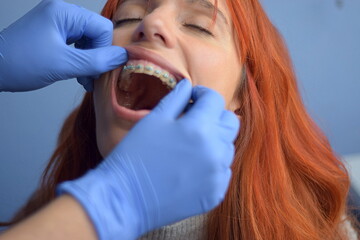 
Doctor checks woman's brackets and teeth