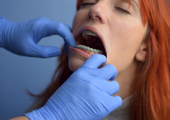 Doctor opens the woman's mouth with his hands to check her brackets and pulls her lips out.