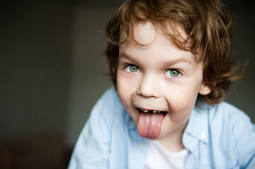 Portrait of a cute emotional child. The concept of changing teeth.