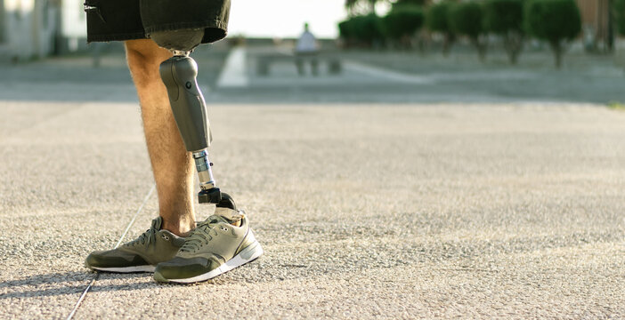 Low Angle View At Disabled Young Man With Prosthetic Leg Walking Along The Street