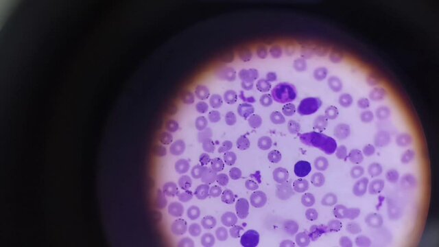 A drop of blood under a microscope