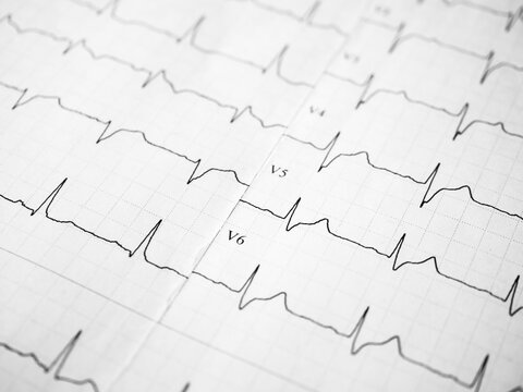Close up of an electrocardiogram in paper form. ECG or EKG record paper. The heartbeat is shown on the graph. Medical and healthcare concept. Minimalism style template for medical blog. Soft focus