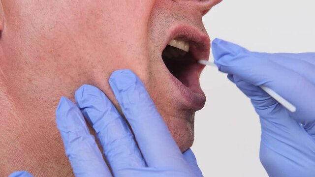 female hands scraping inside of cheeks men, mucous membrane for DNA tests, COVID-19, to determine paternity or presence of virus, determining ethnic origin, paternity, genealogy, family tree