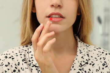 Woman with herpes applying cream onto lip on blurred background, closeup - obrazy, fototapety, plakaty