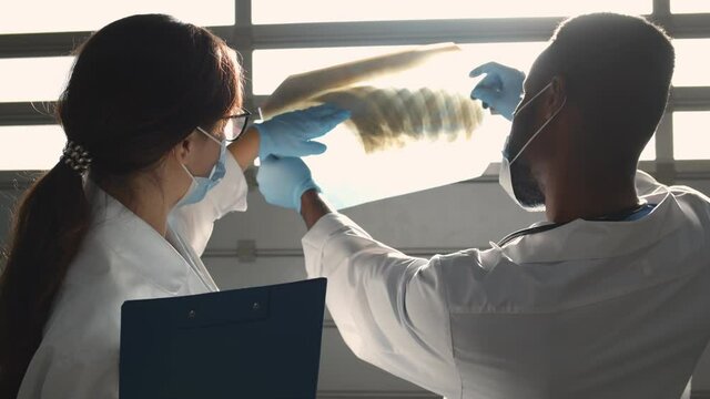 Diverse Doctors Examining Chest And Lung Xray Film Of Patient