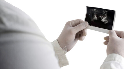 A shot of the prostate in the hands of a doctor isolated on white background