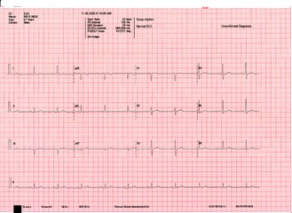 A normal resting ECG report of a patient. Echocardiogram report of a 67 years male patient.