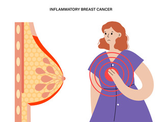 Breast disease concept