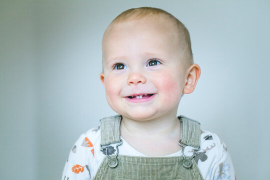 Portrait of a cute little boy. Child with diathesis symptoms on cheeks.