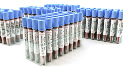 SARS ncov covid 19 blood test tubes, lab test kit