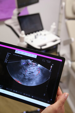 Ultrasound exam tablet display monitor