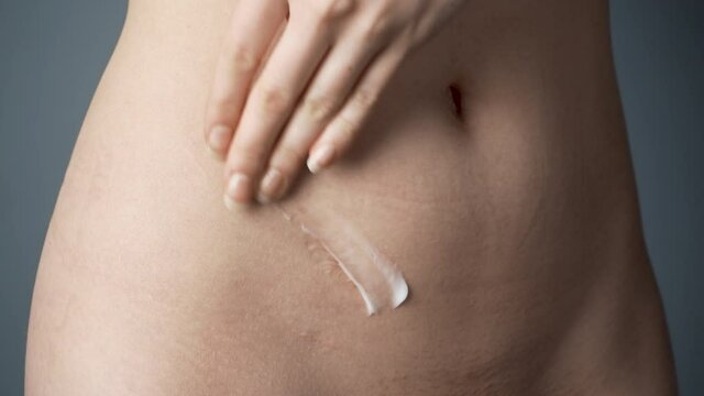 Shooting of woman putting cream on the appendix scar