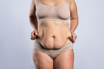 Tummy tuck, flabby skin on a fat belly, plastic surgery concept