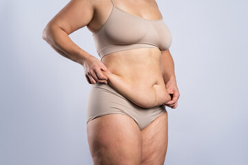 Tummy tuck, flabby skin on a fat belly, plastic surgery concept - obrazy, fototapety, plakaty