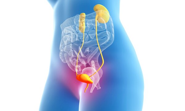 Cystitis, urinary tract infection and inflammation of the bladder, female anatomy 3d illustration on white background