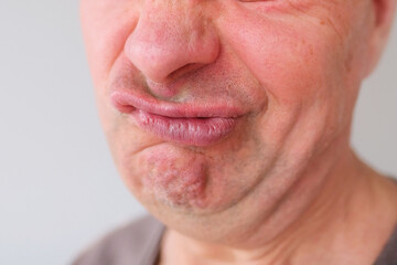 funny face of european adult man close up, wrinkles on aging skin, actor's grimaces, human emotions, mental illness