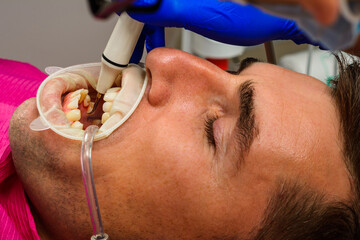Dental practice, the dentist removes stones and hard plaque from the teeth with the help of ultrasound,patient with retractor and saliva ejector in the mouth.