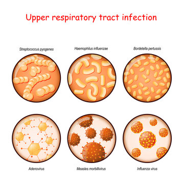respiratory infection. Bacteria and viruses