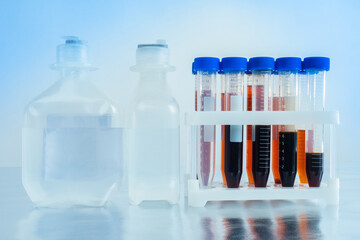 The blood transfusion concept. Blood donation. Test tubes with blood samples and vials with medical preparations. Setting up intravenous droppers.