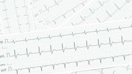 ecg graph on a white paper for medical background 