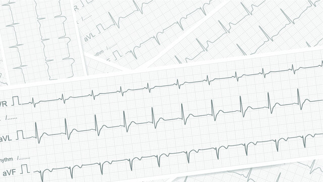 ecg graph on a white paper for medical background 