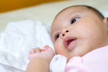 Close Up of Asian Baby Girl Laying In Bed Looking Away/ Close Up of Baby Girl with an open mouth / Scars On Baby Girl's Face