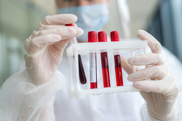 pretty female health worker holding  test tube with blood sample making research