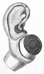 isolated on white detail of wood piercing style on ear of Lengua people (Granc Chaco natives, Paraguay). Ancient grey tone etching style art by Bertall and Hadamard, Le Tour du Monde, 1861
