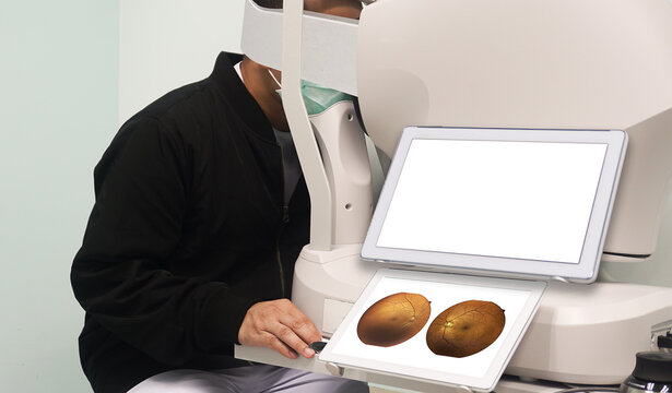 Patients are examining their eyesight with a fundus non-mydriatic camera in a screening room for patients at risk of diabetes.