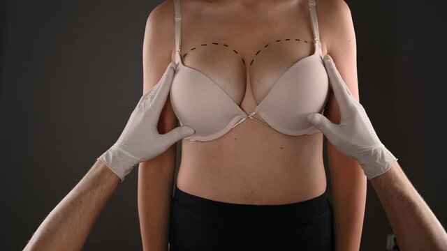 The doctor examines the breasts before cosmetic surgery