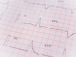 A real chart of an ECG. Electrocardiogram registered on paper. Heart's electrical activity. Medical and healthcare concept for background. Selective focus. Close up. Piece of ECG. Free space to write.