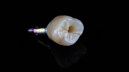 beautiful ceramic crown on black glass with reflection