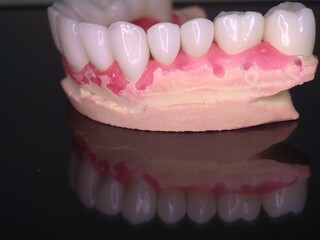 Macro shot of beautiful teeth. Zirconia crowns  on the diagnostic model of the upper jaw against a dark background with reflection © MYKHAILO 