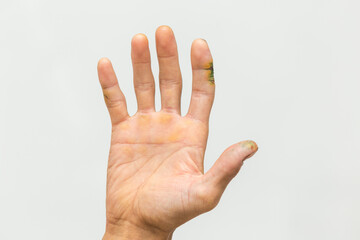 Close-up of a man cutting a hand on a white background. Dry, cracked skin. Wounds and cracks in the fingers. Skin disease. Lightly injured. Hand skin care. Dermatology and treatment concept