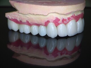 Macro shot of beautiful teeth. Zirconia crowns  on the diagnostic model of the upper jaw against a dark background with reflection © MYKHAILO 