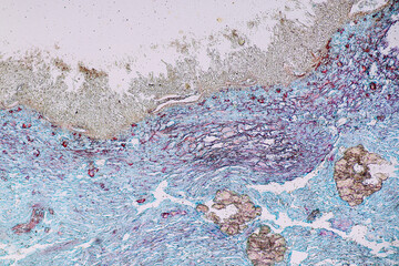Penicillium, ascomycetous fungi are of major importance in the natural environment as well as food...