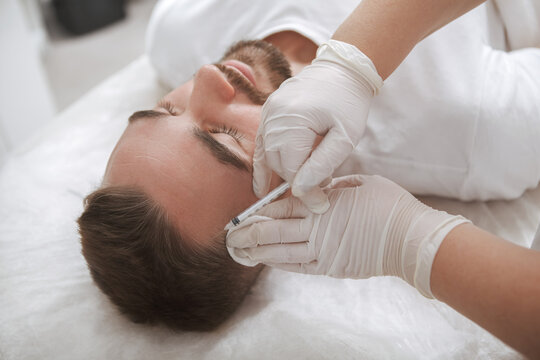 Unrecognizable professional trichologist giving hairloss injections treatment to male client
