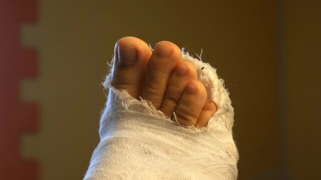 male leg in a plaster cast. toes moving. Plain background, close-up.