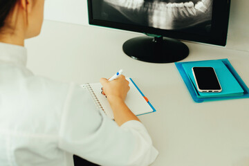 Doctor girl holding x-ray of the jaw. The dentist makes a description of the x-ray of the patient's...