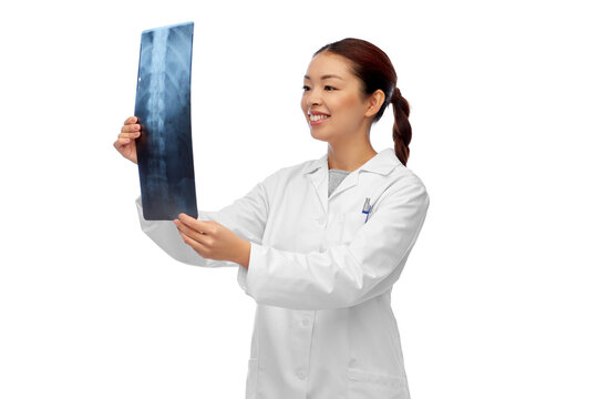 medicine, radiology and healthcare concept - happy smiling asian female doctor in white coat looking at x-ray scan image of spine