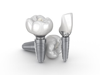 Ceramic crowns, custom implant abutment and implantats. Medically accurate 3D illustration of dental implantation