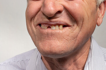 The toothless smile of an old European man on a gray background. Dentistry for pensioners, happy old age