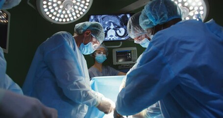 Group of mixed-races professional surgeons and nurses in uniform performing heart transplant surgery operation under bright lamps using medical instruments in operating room looking at screen - Powered by Adobe