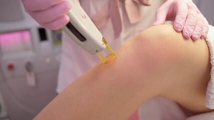 hair removal procedure video footage pulses of laser light for  beautician salon. Slow motion. Woman client leg and pink gloves of the doctor holding machine. Professional hair removing procedure 
