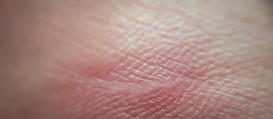 Macro of human skin texture. Dermatology pattern of healthy brown caucasian skin. Close up detail of skin for background