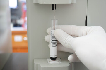 Analysis  for clotted blood samples in the clinical chemistry
