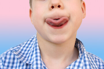 boy, kid performs articulation exercises for development of speech apparatus, close-up tongue, concept of speech disorders, methods for correction, methods of correctional developmental exercises