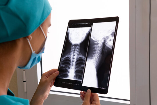 Side view of young female medical specialist in surgical gown and protective mask examining X ray image of neck cervical spine of patient in hospital