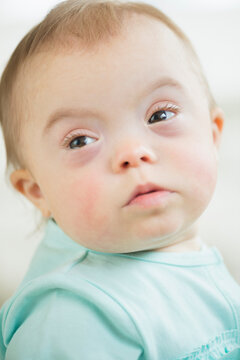 Caucasian baby girl with Down Syndrome