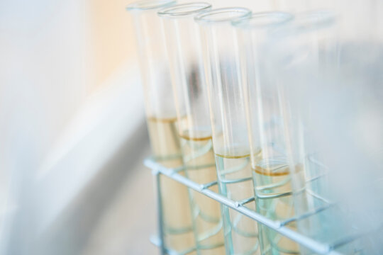 Yellow liquid in test tube rack
